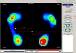 huella plantar estudio podologo bogota huella plantar por medico podologo