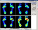 huella plantar por medico podologo bogota estudios huella plantar por medico podologo