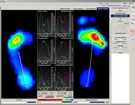 huella plantar por medico curvas podologo bogota huella plantar por medico podologo