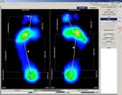 huella plantar centro gravedad podologo bogota huella plantar por medico podologo
